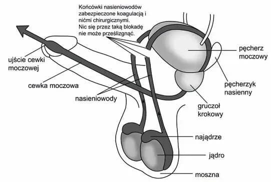Czy wazektomia to grzech? Odkryj moralne aspekty w Kościele katolickim